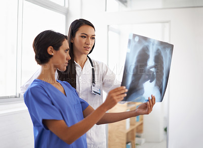 Buy stock photo X ray, doctor and nurse with results in hospital, medical facility or clinic for lung exam or radiology. Women, people and healthcare workers with document, research or analysis of respiratory system