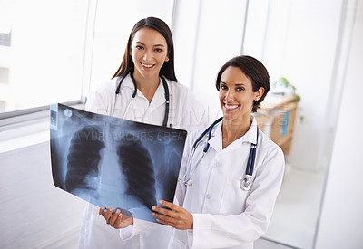 Buy stock photo Portrait, x ray and doctors with results in hospital, medical facility or clinic for lung exam. Women, people or healthcare workers with radiology document, research or analysis of respiratory system