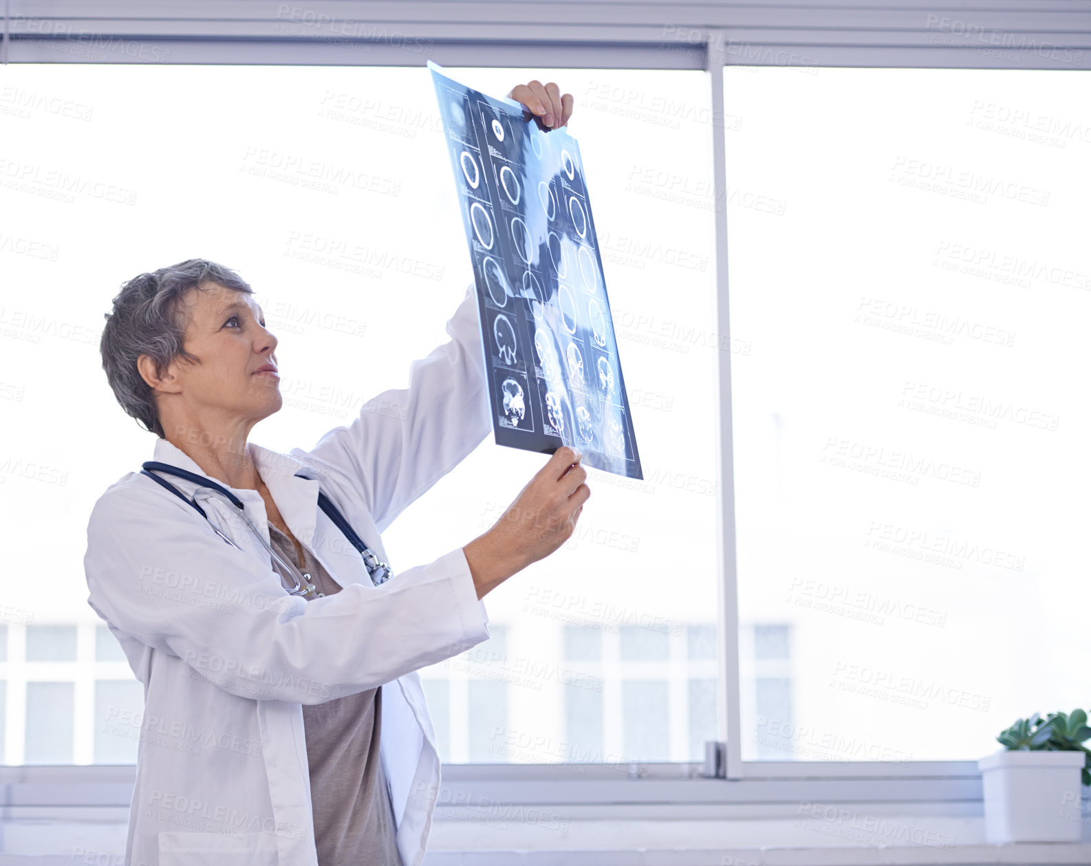 Buy stock photo Woman, senior doctor and review xray for planning medical treatment, surgery and healthcare at hospital. Brain scan, neurology and radiology with surgeon for health assessment,  anatomy and MRI