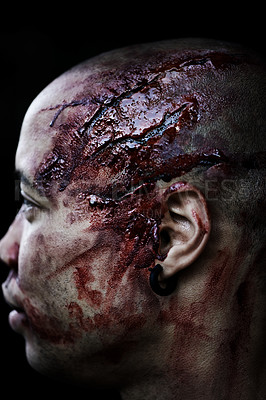 Buy stock photo A cropped shot of a man's wounded head covered in blood