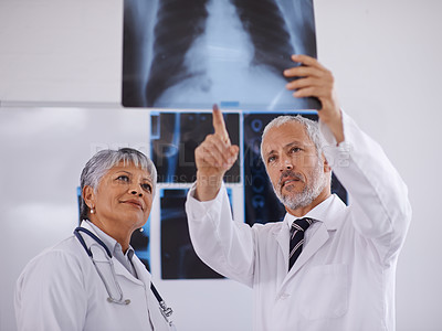 Buy stock photo Senior team of doctors, check xray for surgery with people in radiology and cardiovascular health at clinic. Lung scan, old man and woman surgeon collaboration with assessment and problem solving

