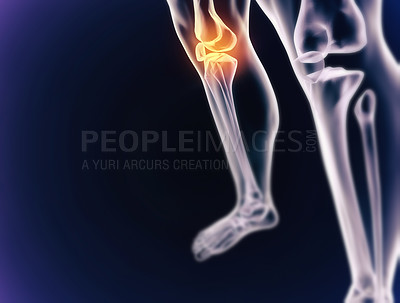 Buy stock photo A cgi view of an inflamed joint isolated on blue 