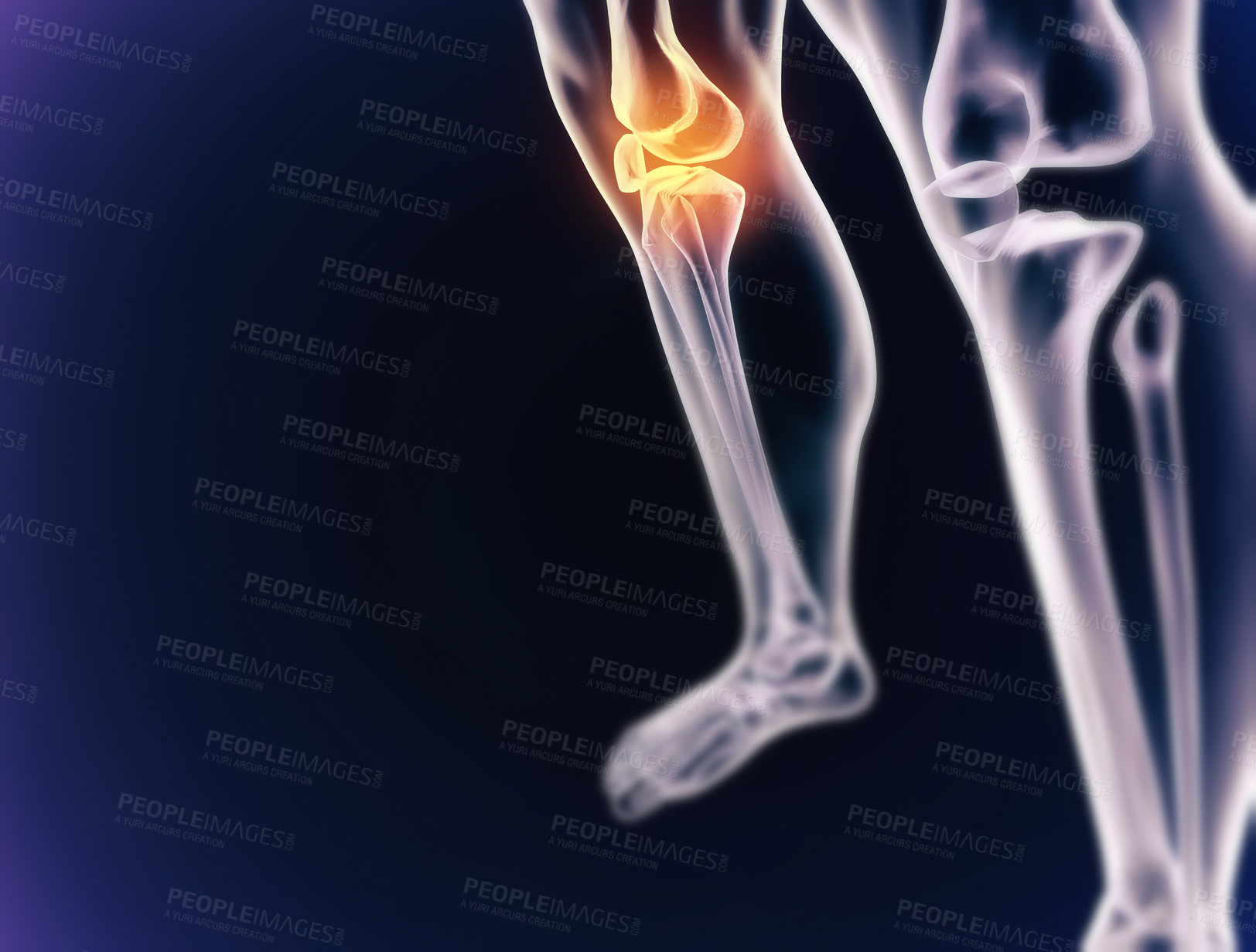 Buy stock photo A cgi view of an inflamed joint isolated on blue 