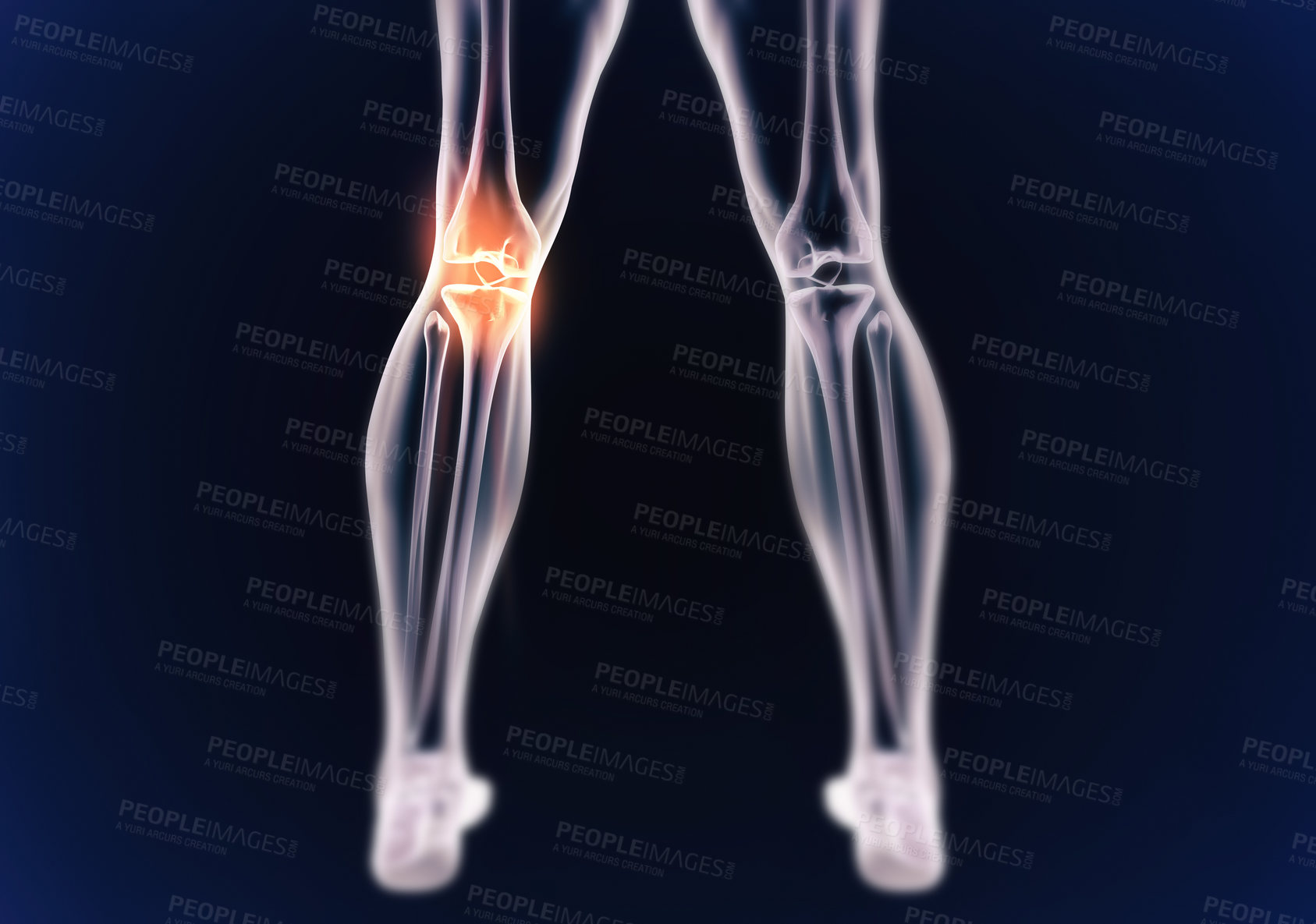 Buy stock photo Legs, skeleton and red pain with graphic for xray, exam and analysis in healthcare overlay and dark or black background. 3D of anatomy, radiology and knee or joint illustration for injury and physio