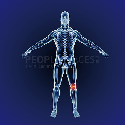 Buy stock photo Body, knee pain and skeleton of bones on x ray scan on digital screen. Research of bone and hologram of a person with an internal injury, xray results or feedback of patient exam or operation