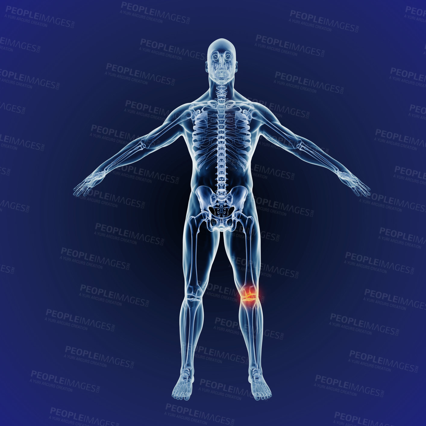 Buy stock photo Body, knee pain and skeleton of bones on x ray scan on digital screen. Research of bone and hologram of a person with an internal injury, xray results or feedback of patient exam or operation