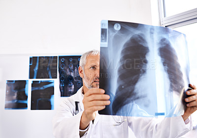 Buy stock photo Shot of a mature male doctor looking at a x-ray image at a hospital