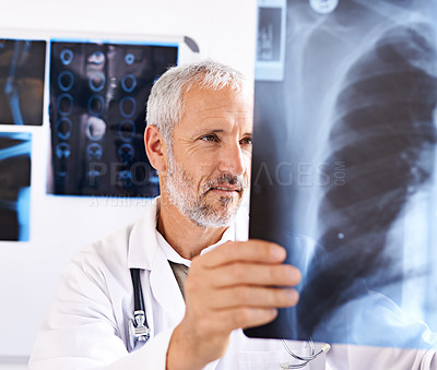Buy stock photo Senior surgeon, analysis and xray for thinking, health service and orthopedic man with ideas for lung surgery. Medicine, radiology and study for bronchitis and problem solving with doctor in clinic