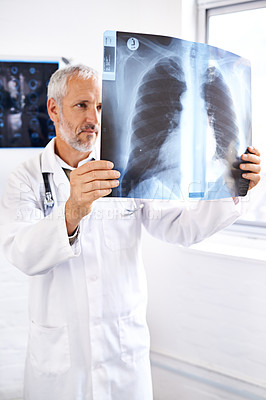 Buy stock photo Senior doctor, research and xray for thinking, health service and orthopedic man with ideas for lung surgery. Medicine, radiology and study for bronchitis and problem solving with surgeon in clinic