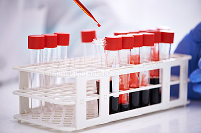Buy stock photo Blood test, tube for science in laboratory, research and studying monkeypox virus, infection and viral disease. Medical study, sample and analysis of pathology, biology and immunity in dna innovation