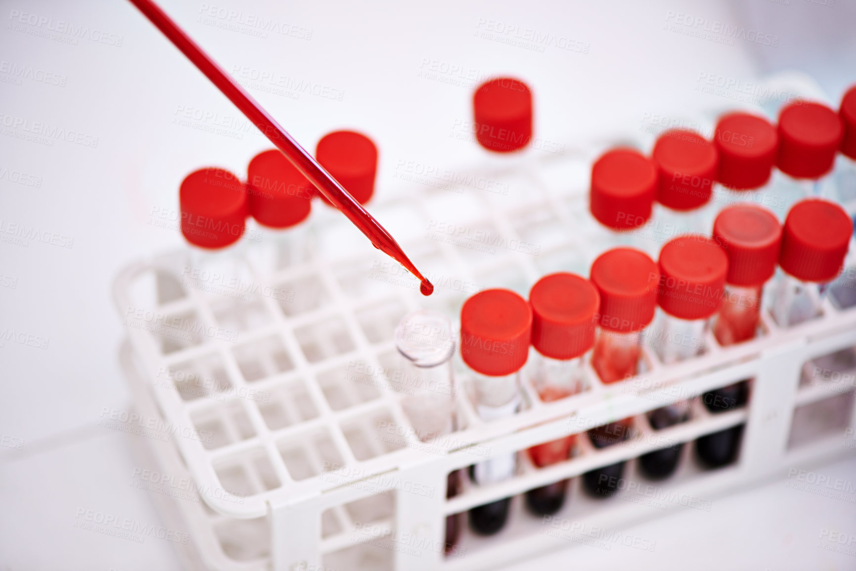 Buy stock photo Blood study, tube for science in laboratory, research and studying monkeypox virus, infection and viral disease. Medical test, sample and analysis of pathology, biology and immunity in dna innovation