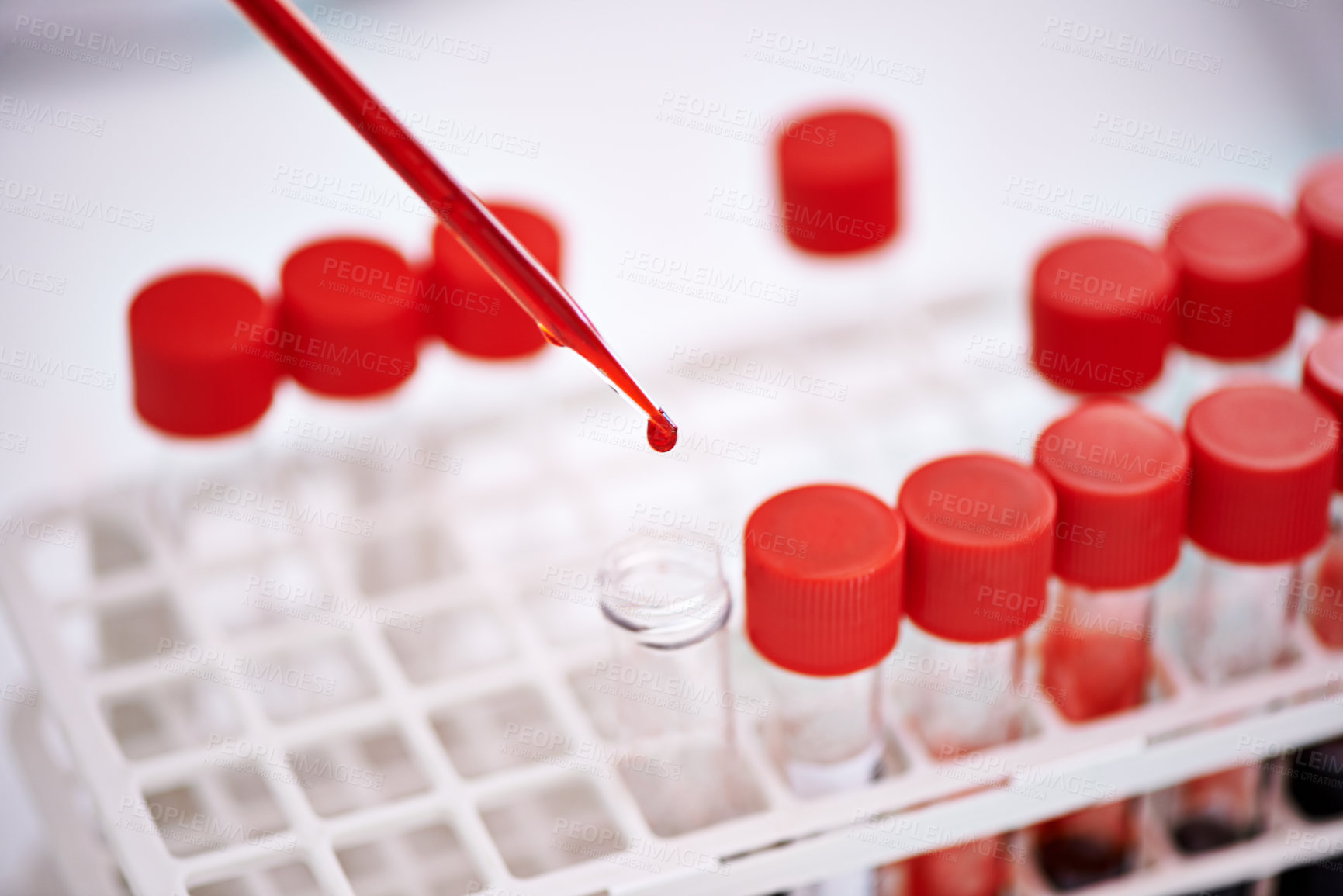 Buy stock photo Blood test, pathology for science in laboratory, research and studying monkeypox virus, infection and viral disease. Medical study, tube and analysis of sample, biology and immunity in dna innovation