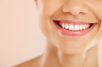 Good teeth are important for a winning smile- Dental