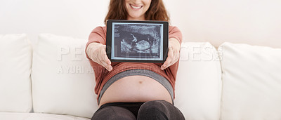 Buy stock photo Shot of glowing young pregnant woman showing her ultrasound on a digital tablet