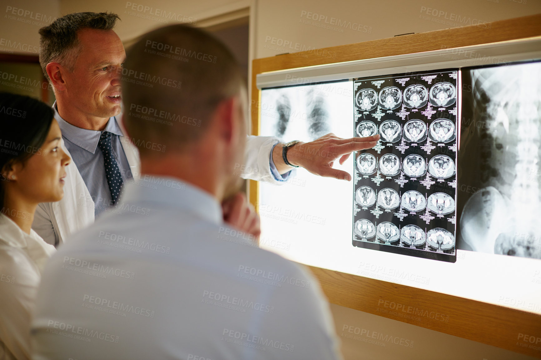 Buy stock photo Shot of a team of surgeons discussing a patient’s medical scans