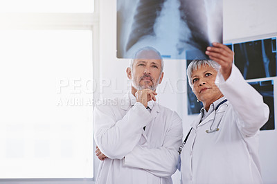 Buy stock photo Senior team of doctors, review xray for surgery and people in radiology, cardiovascular health at clinic. Lung scan, old man thinking about diagnosis and woman surgeon collaboration with assessment

