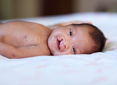 Buy stock photo Portrait of a baby girl with a cleft palate lying on a bed. A newborn girl was born with an opening in the roof of the mouth. An infant with a birth defect smiling while lying on a bed. 