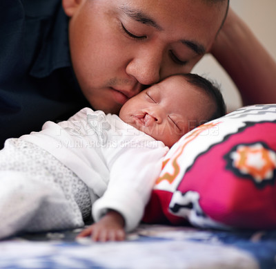Buy stock photo Shot of a young father bonding with his baby girl who has a cleft palate