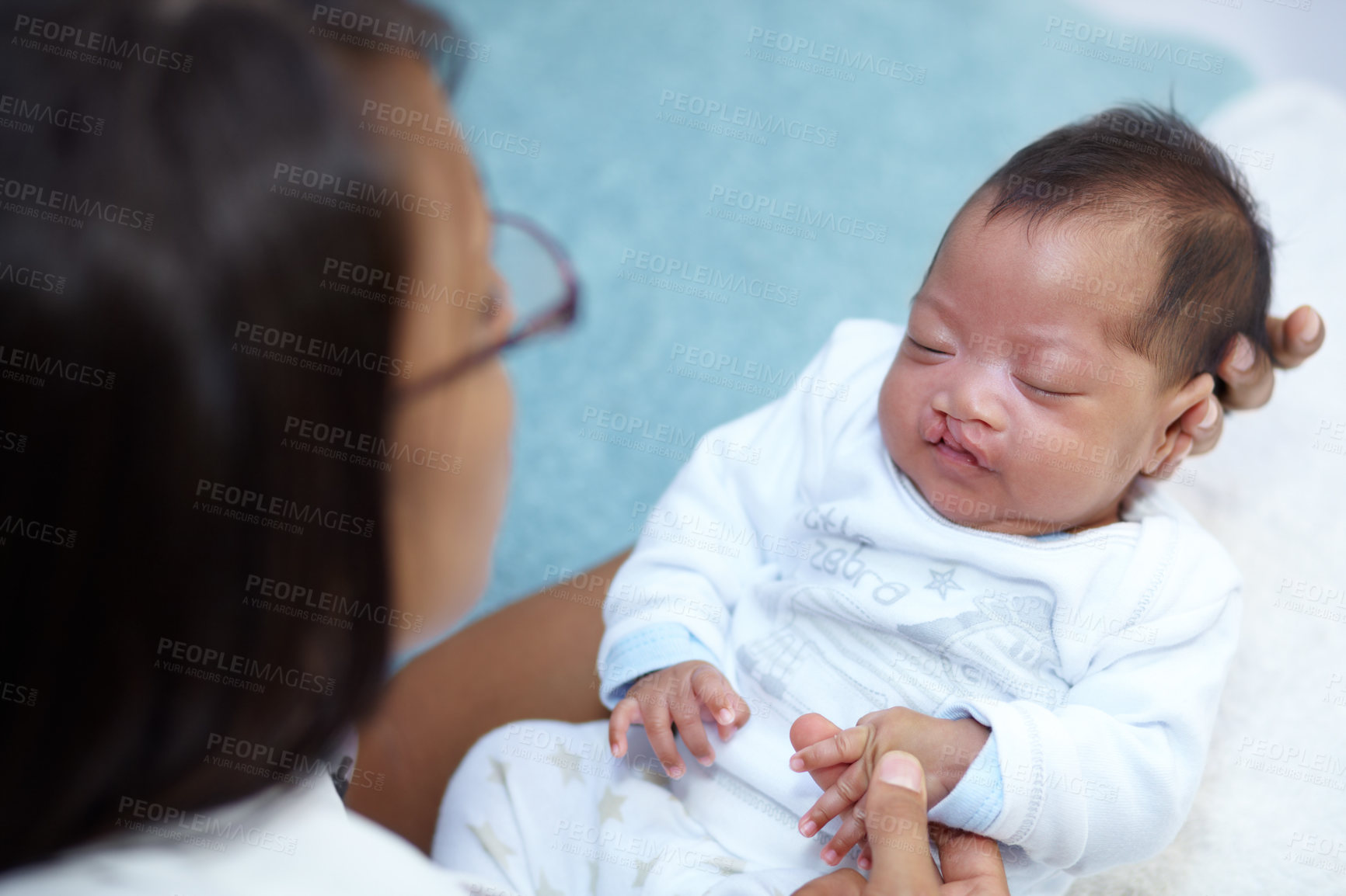 Buy stock photo Shot of a sleeping baby girl with a cleft palate being held by her mother