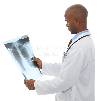 Buy stock photo Doctor, black man or check xray scan for lung cancer evaluation, clinic research or medical investigation. Studio MRI, radiology or African surgeon with anatomy assessment results on white background