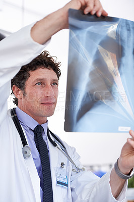 Buy stock photo Doctor, man and xray in hospital for reading results with thinking for lungs, decision or healthcare. Professional medic, check and film paper for respiratory system exam for asthma with radiology