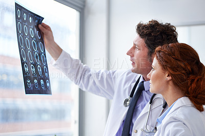Buy stock photo Doctors, brain scan and check results at hospital with teamwork, review and healthcare by window. Neurology, man and woman with xray reading for wellness, ideas and decision with document in clinic