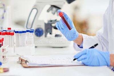 Buy stock photo Closeup shot of a scientist examining a blood sample and recording findings in a lab