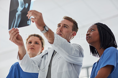 Buy stock photo Cropped shot of a group of medical practitioners viewing an x-ray together