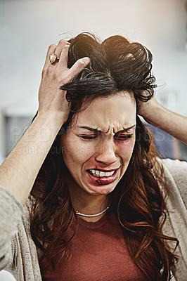 Buy stock photo Shot of a beaten and bruised young woman crying with her hands in her hair
