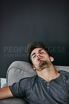 Buy stock photo Cropped shot of a beaten and bruised young man sleeping on the sofa