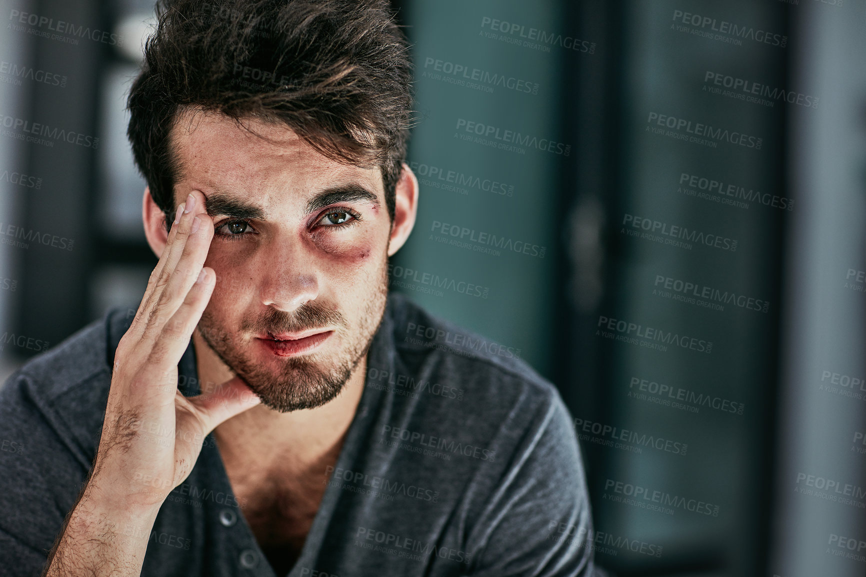 Buy stock photo Domestic violence, bruise or face of sad man in house with depression, fear or anxiety for fighting, conflict or attack trauma. Facial, wound or victim with injury from abuse, disaster or horror ptsd