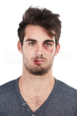 Buy stock photo Man, portrait and black eye in studio for fight, conflict and hurt, bruise and abuse victim on white background. Face, male and facial injury, blood and wound, domestic violence and scratch isolated
