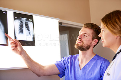 Buy stock photo Shot of a young doctor and a male nurse examining an x-ray together