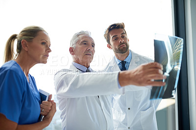 Buy stock photo Cropped shot of a group of medical practitioners examining an x-ray together