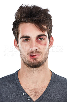 Buy stock photo Portrait, facial and injury by man in studio for black eye, accident or fight on white background. Face, danger and domestic violence victim with wound, blood and injured while standing isolated