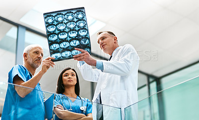 Buy stock photo Doctor, team and x ray for healthcare in hospital, analysis and check results of patient MRI. People, collaboration and CT scan or assessment, cooperation and consulting or low angle for anatomy