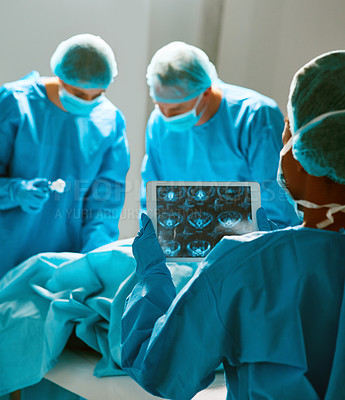 Buy stock photo Surgery, operating room and team of doctors with scan for healthcare, teamwork and focus on professional medicine. Medical innovation, technology and surgeon with xray, tablet and staff in hospital. 