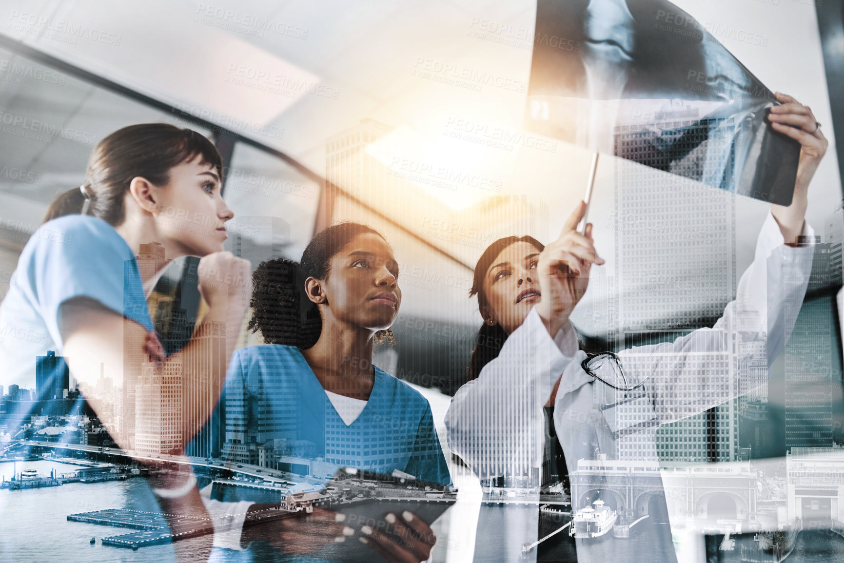 Buy stock photo Cropped shot of a group of doctors discussing the results of an X-ray in a hospital