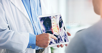Buy stock photo Shot of an unrecognizable doctor showing an x ray scan to a senior patient