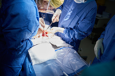 Buy stock photo Shot of a group of doctore performing surgery in the hospital