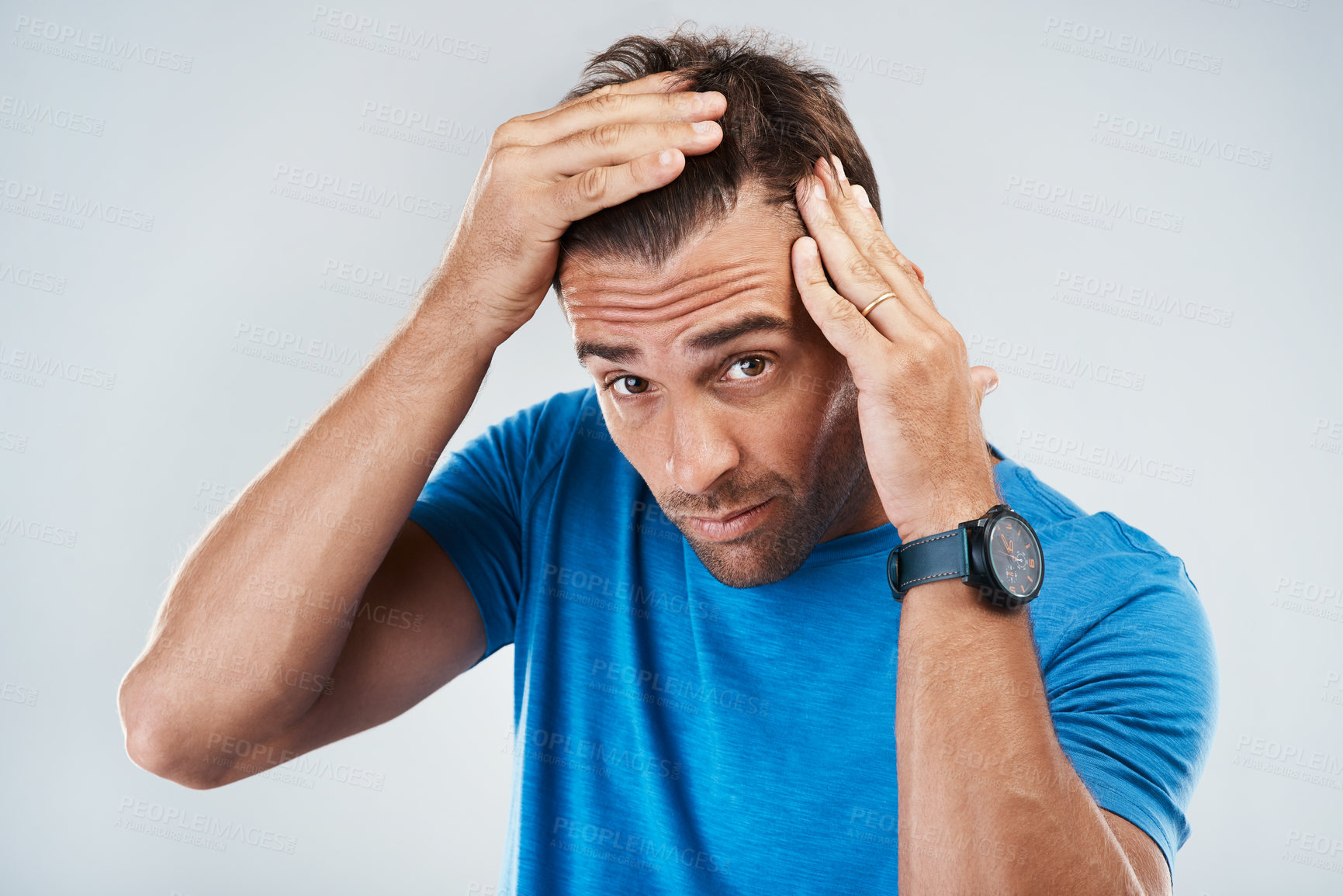 Buy stock photo Man, worried portrait and check for hair loss with crisis, hereditary disease and thyroid problem in studio. Guy, stress and scalp inspection for alopecia, testosterone and aging by white background