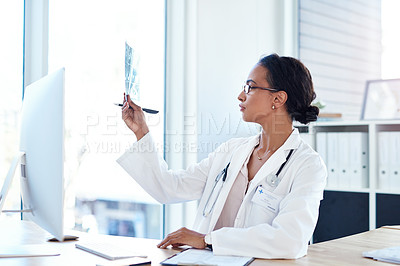 Buy stock photo Check, x ray and woman in office, doctor and medical professional with radiography, analysis or glasses. Hospital, healthcare and document to diagnose, vision and examination for results or treatment