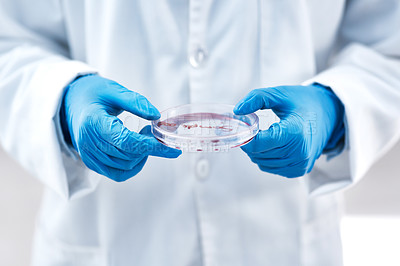 Buy stock photo Hands, petri dish and pharmaceutical research for bacteria, medicine and medical development. Person, laboratory and discovery for innovation, life extension and professional biochemistry expert