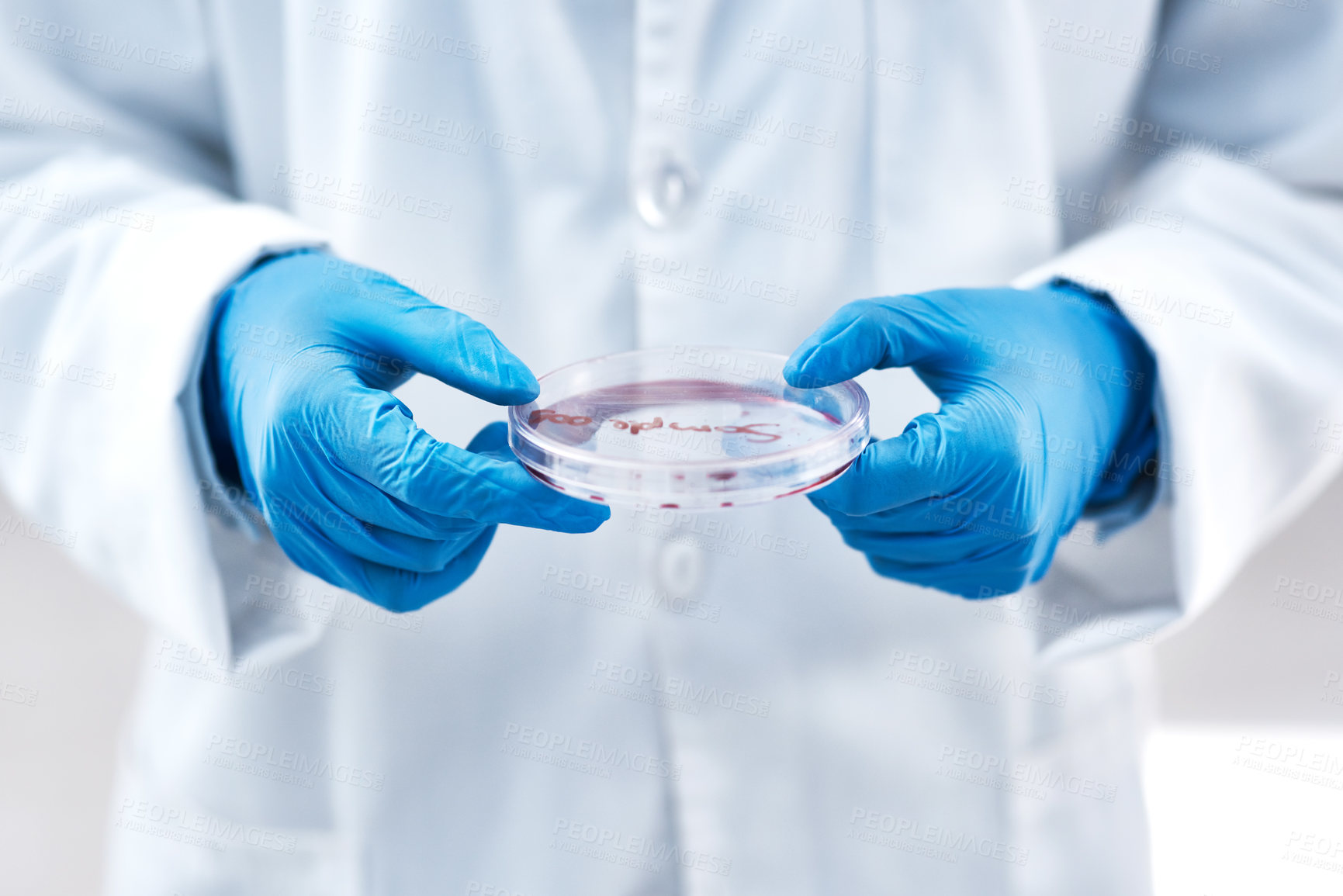 Buy stock photo Hands, petri dish and pharmaceutical research for bacteria, medicine and medical development. Scientist, laboratory and discovery for innovation, life extension and professional biochemistry expert