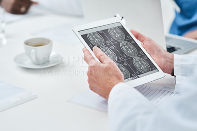 Buy stock photo Closeup shot of an unrecognisable doctor analysing brain scans on a digital tablet