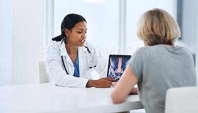 Buy stock photo Doctor, woman and tablet with spine x ray, feedback or advice for injury, pain or talking with app for support. Medic, women and touchscreen for physiotherapy, osteoporosis and explain for healthcare