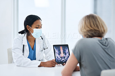 Buy stock photo Doctor, patient and woman with tablet for spine, feedback or advice for injury, pain or safety with mask for covid. Medic, women and touchscreen for consulting, osteoporosis and explain with x ray