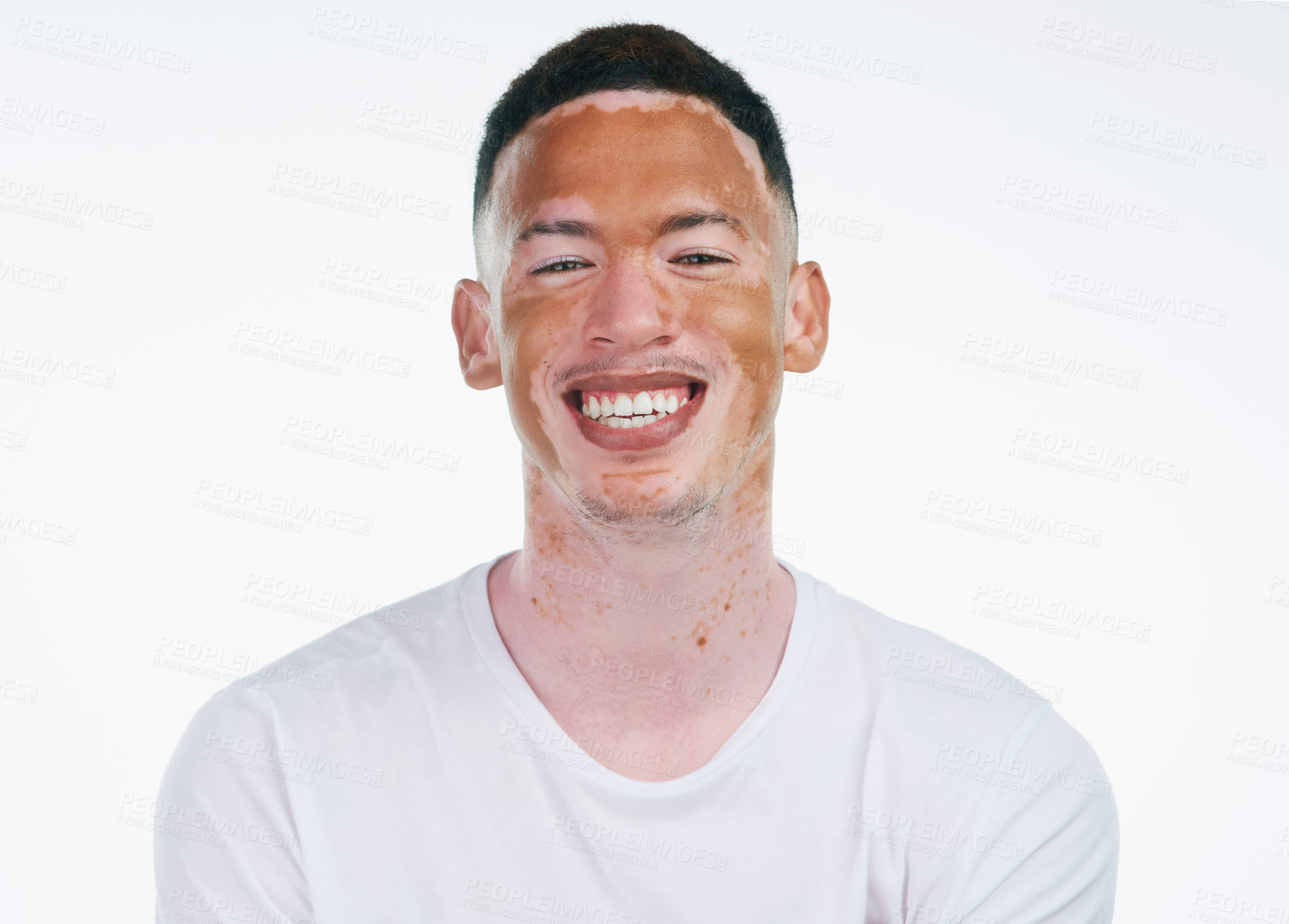 Buy stock photo Portrait shot of a handsome young man with vitiligo posing on a white background