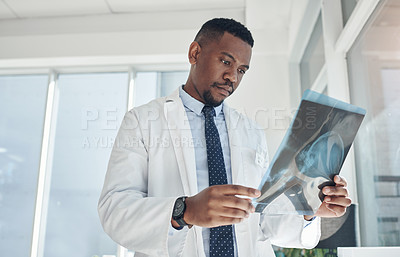Buy stock photo Hospital, doctor and black man with xray in office for neurology results, healthcare and assessment. Medical professional, clinic and person with radiology film for neuroscience, analysis and review