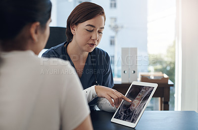 Buy stock photo Doctor, woman and tablet for x ray in anatomy, surgery or results in MRI, CT and body scan at hospital. Chiropractor, technology and consulting for spine, patient analysis and cervical vertebrae